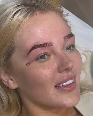 Client showing her combination brow treatment